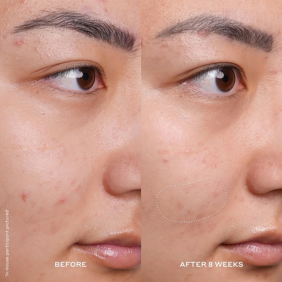 NIB Ole Henriksen Truth Serum with Orange Glow Banana Bright Vitamin C Serum - Picture 5 of 16